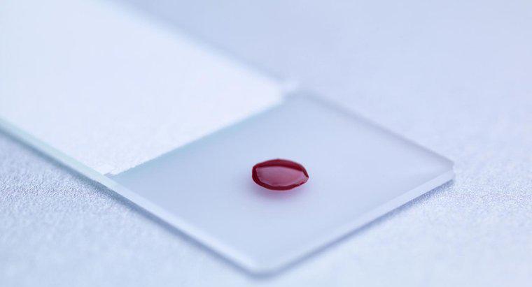 O que é um exame de sangue LDH?