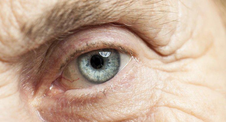 O que se pode esperar de sua visão imediatamente após a cirurgia de catarata?