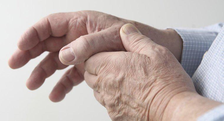 Qual é o melhor tratamento para ajudar as mãos com artrite?