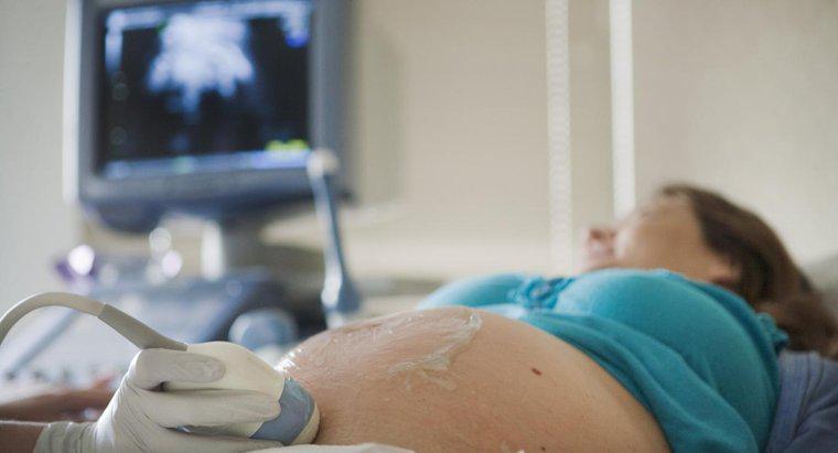 Quando um ultrassom mostrará o sexo de um bebê?
