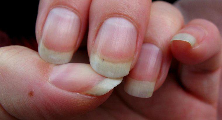O que causa saliências nas unhas?