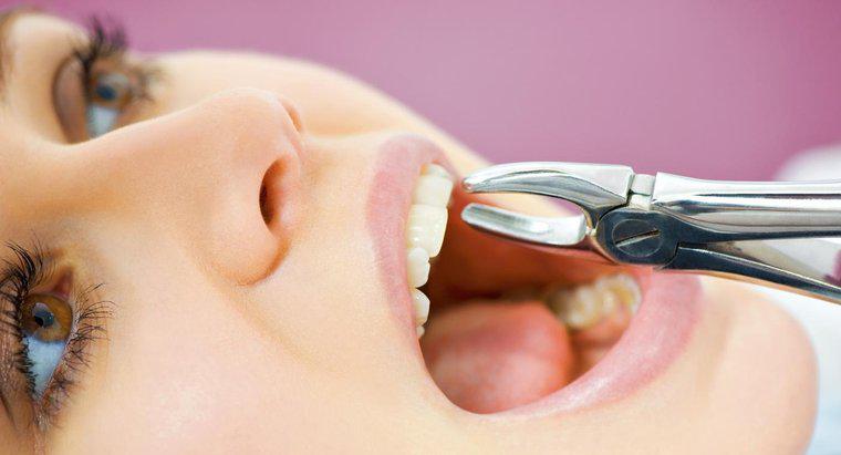 Quanto tempo leva para uma cavidade cicatrizar depois que um dente é arrancado?
