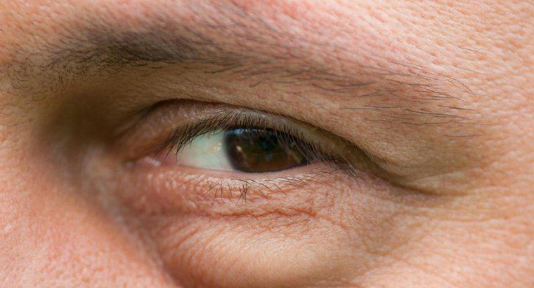 Quais são as possíveis causas do inchaço sob os olhos?