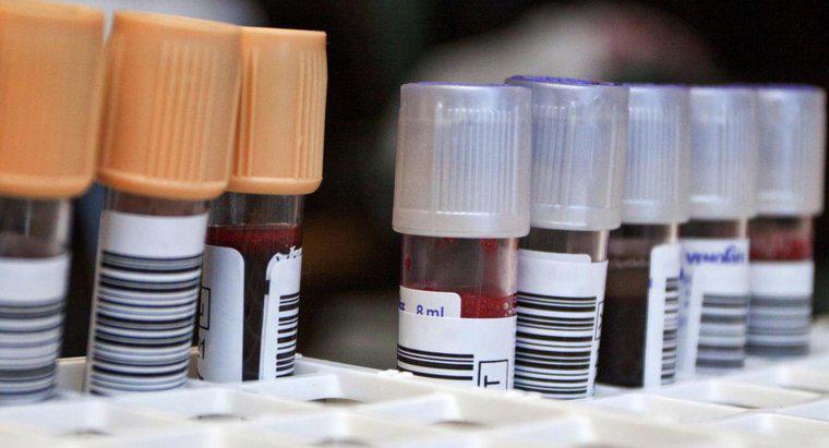 O que é um exame de sangue de neutrófilos?
