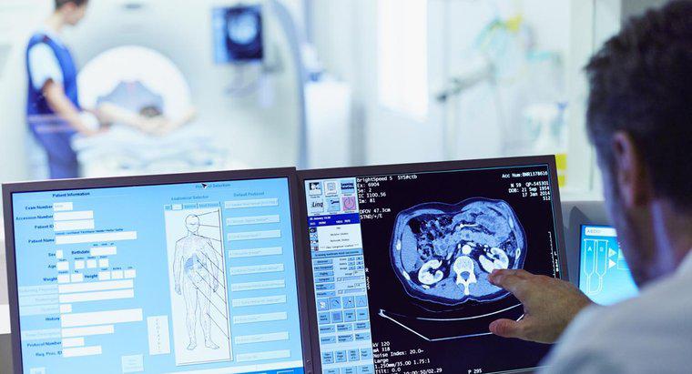 Quanto tempo leva para obter resultados de tomografia computadorizada?