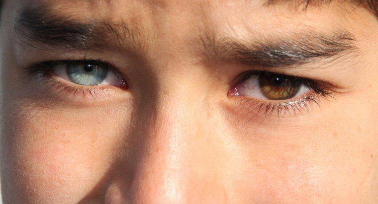 Quão rara é a heterocromia em humanos?