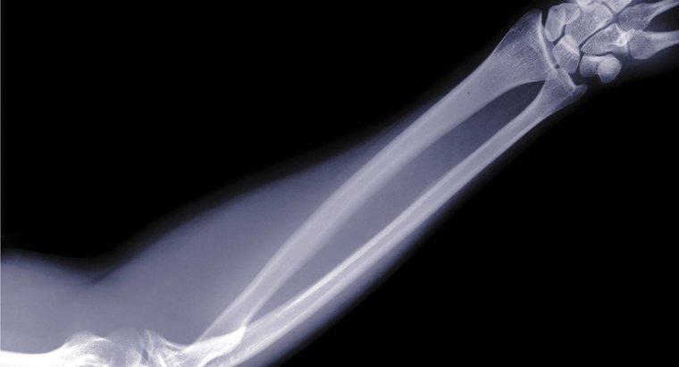 Quais são os nomes dos ossos no braço humano?