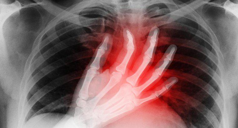 Quais são os sintomas de um mini ataque cardíaco?