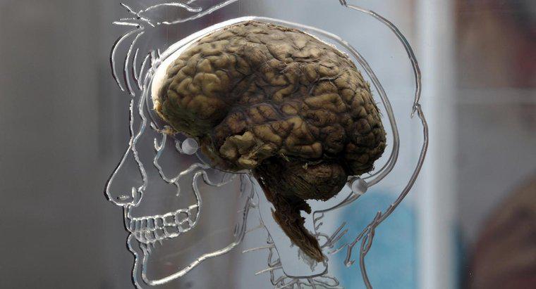 Quais são os sintomas de uma lesão cerebral?