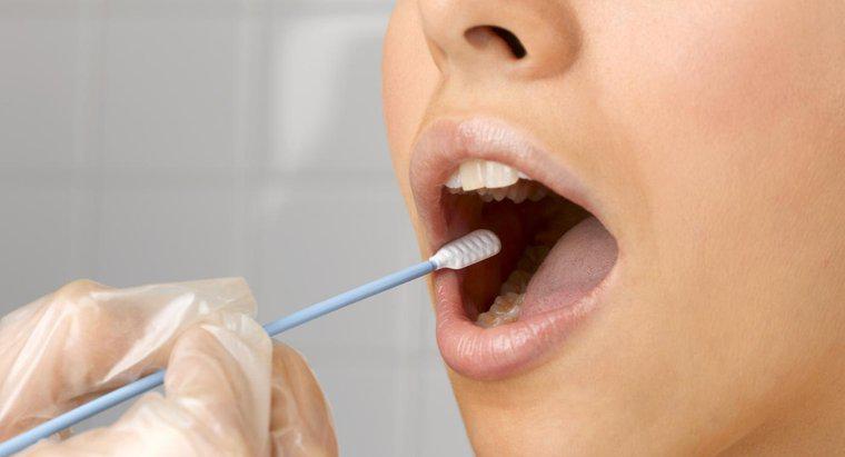Quão precisos são os testes de drogas com esfregaço bucal?