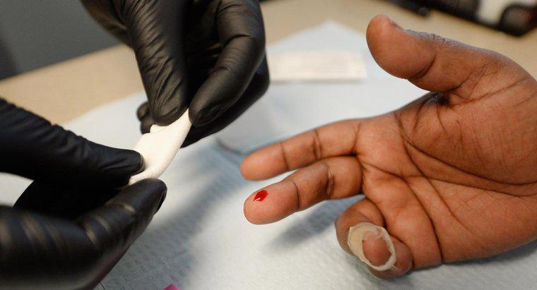 Quanto tempo leva para o HIV aparecer nos testes?