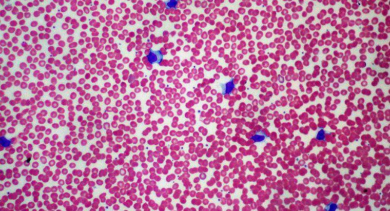 O que significa uma linfa alta em um hemograma completo?