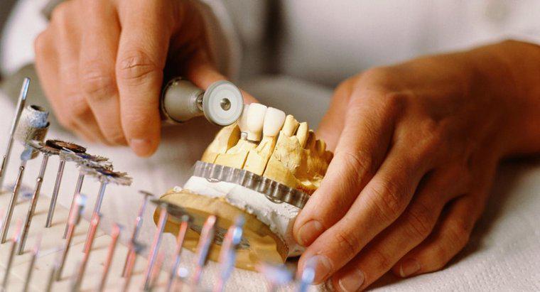 O que são próteses parciais dos dentes anteriores?