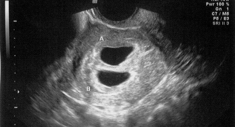 Um ultrassom pode detectar uma gravidez em 4 semanas?