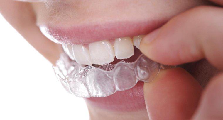 Como você endireita os dentes sem aparelho?