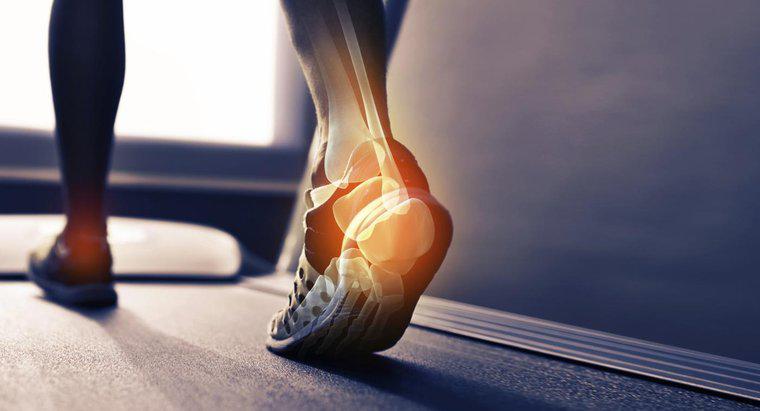 O que causa um esporão ósseo no calcanhar do seu pé?