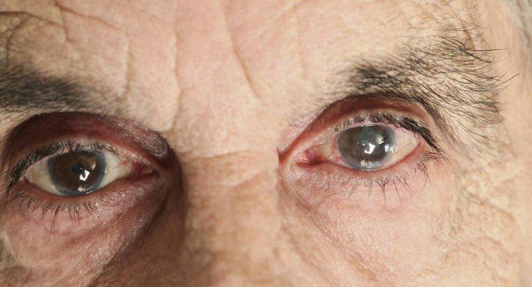 O que causa uma película turva sobre o olho?