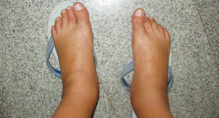 Quais são as causas dos pés inchados?