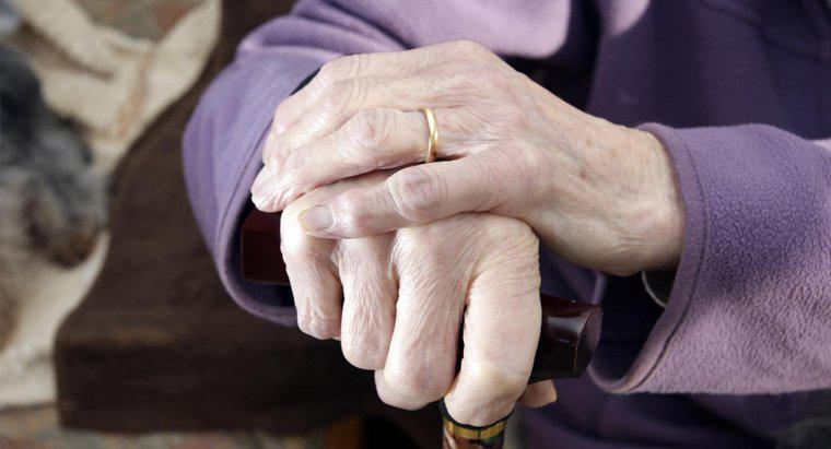 Como é diagnosticada a artrite nas mãos?