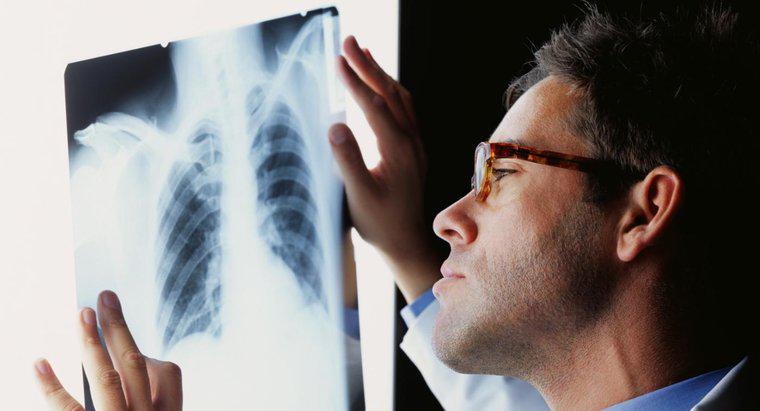 Como uma infecção pulmonar é tratada?