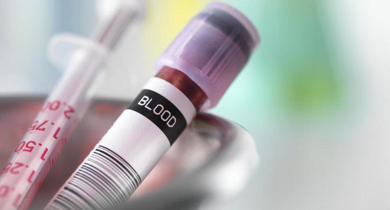 Como os médicos diagnosticam a causa de uma contagem baixa de hemoglobina?