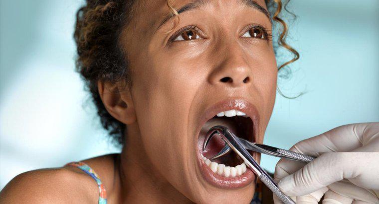 Como você trata uma infecção após a extração de um dente?