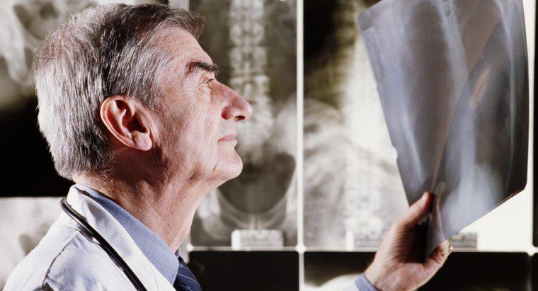 Quais são as desvantagens dos raios-X?