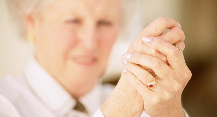 Quais são os sintomas da artrite reumatóide nos dedos?