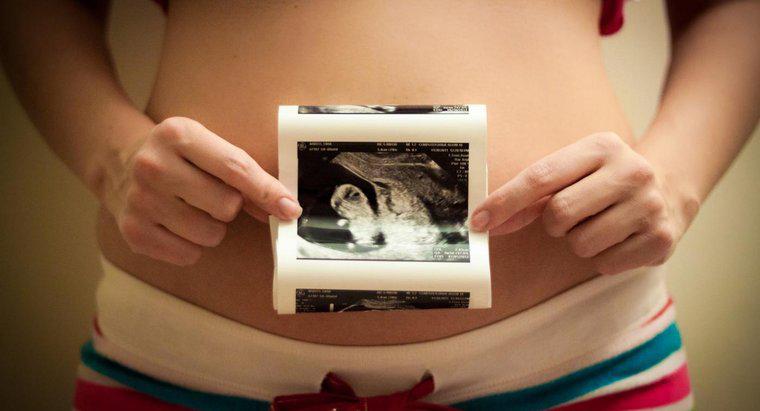 Qual é a ordem correta das fases do desenvolvimento pré-natal?