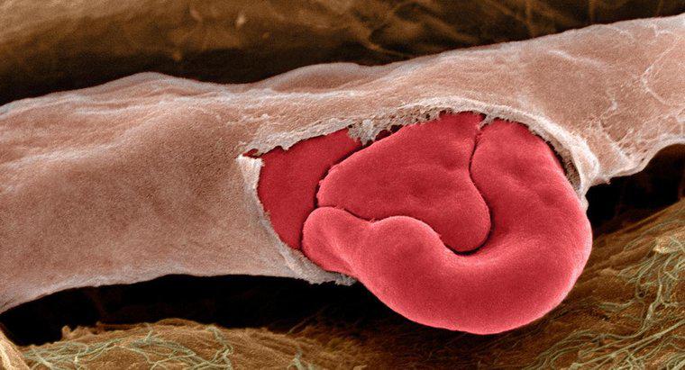 O que faz com que os vasos sanguíneos se rompam?