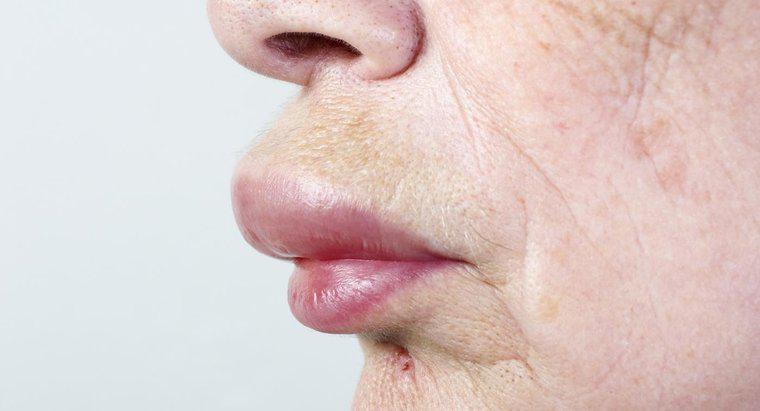 Como você cura um inchaço no lábio e no rosto?