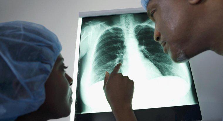 Quais são as diferentes opções de tratamento para fluidos nos pulmões?