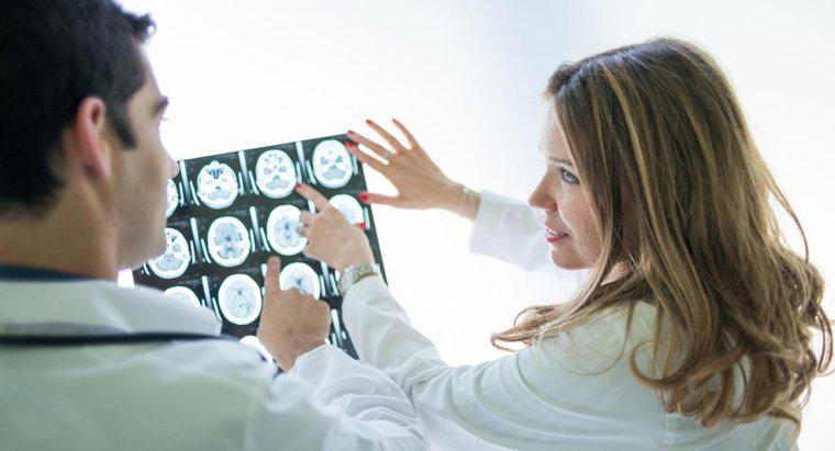 Quais são alguns sintomas de um tumor cerebral?