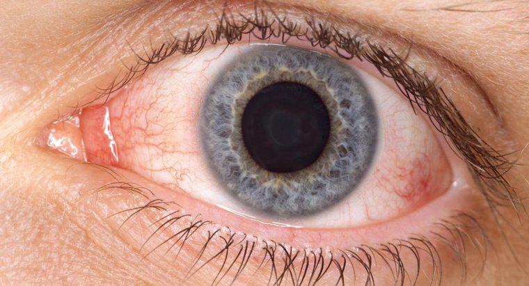 Como o ácido bórico ajuda com o olho rosa?