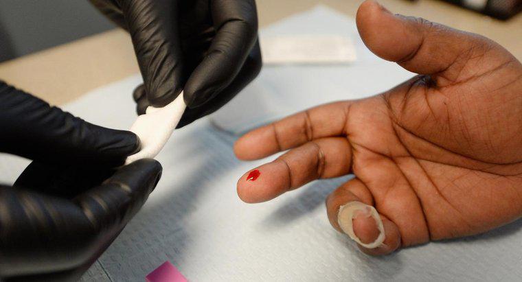 Quais são os primeiros sintomas do HIV?