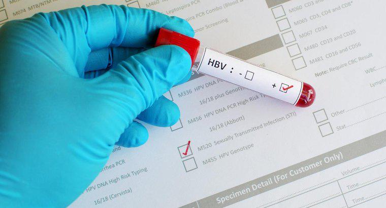 O que um resultado positivo indica em um teste de hepatite B?