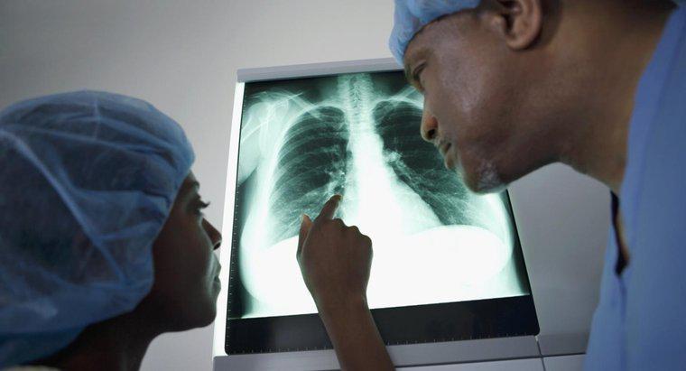 O que significa uma missa no pulmão?