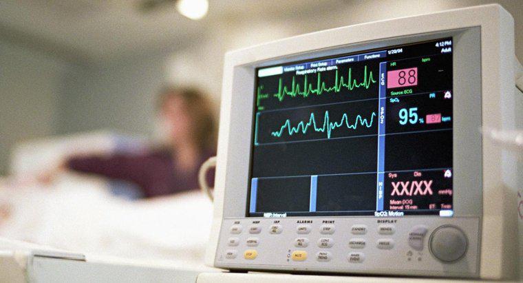 O que é um ecocardiograma?