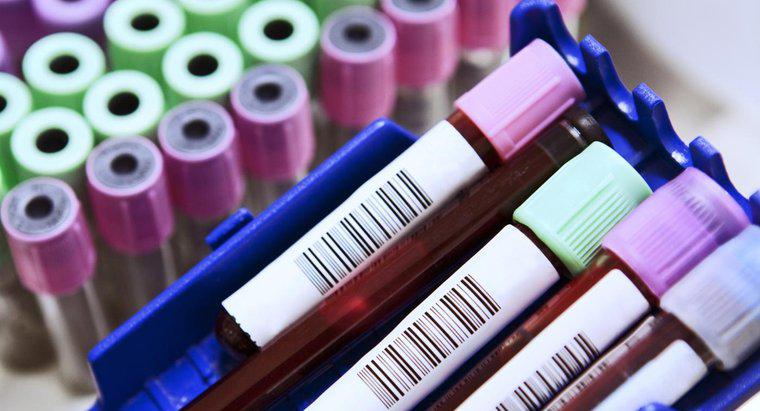 O que são abreviações comuns em um exame de sangue?