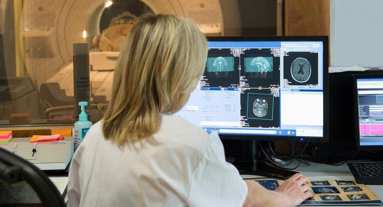 O que significa uma mancha branca em uma ressonância magnética do cérebro?