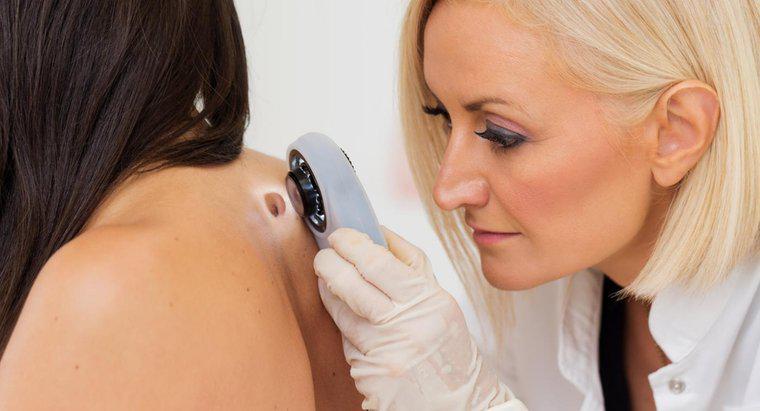 Quais sites médicos mostram imagens de tipos de câncer de pele?
