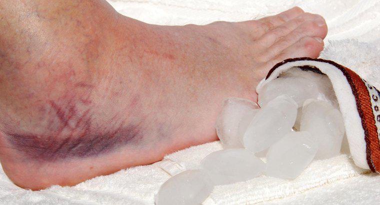 O hipotireoidismo pode causar inchaço nos tornozelos?