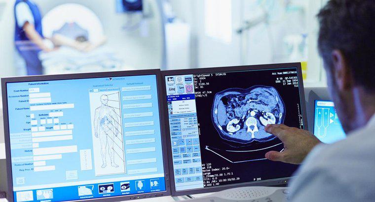 Quais são as vantagens e desvantagens das tomografias computadorizadas?