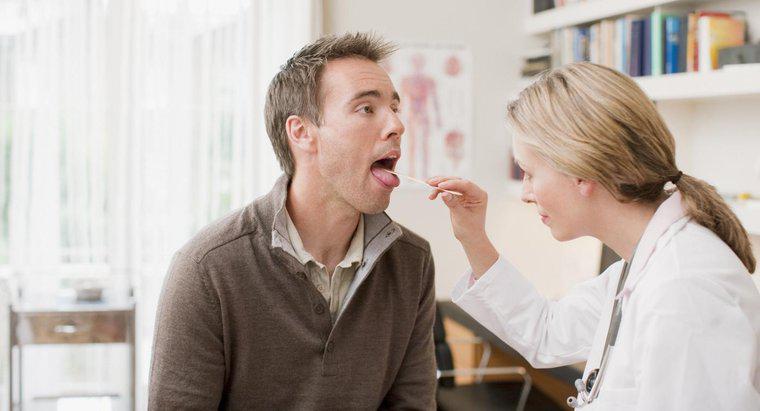 O que indicam as glândulas inchadas sob a língua?