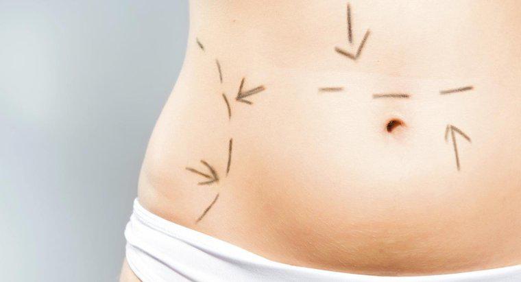 Qual é o objetivo de uma abdominoplastia?