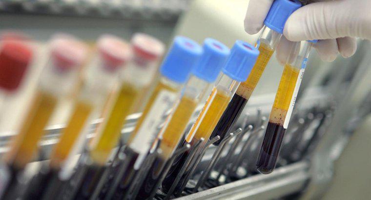 O que é HCT em um teste de sangue?