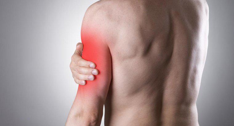 Um nervo comprimido pode causar dor no braço esquerdo?