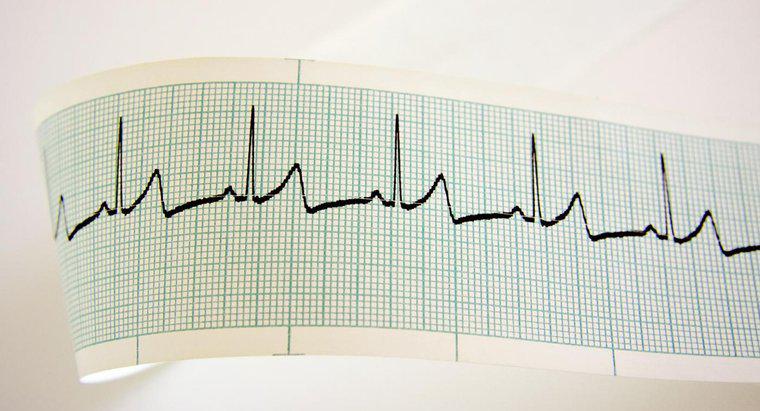 Qual é a frequência cardíaca média para uma mulher?