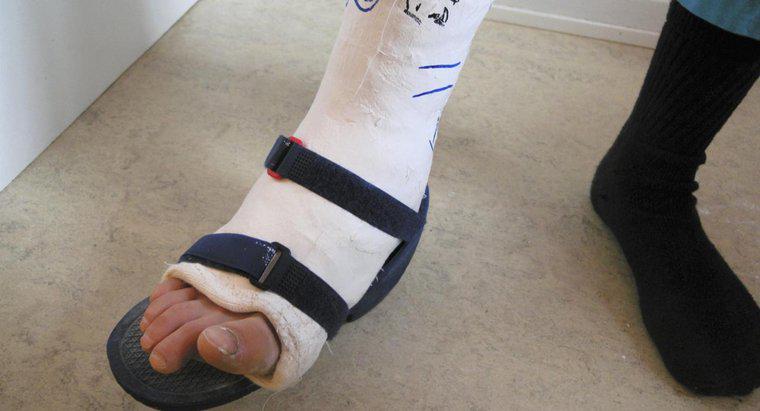 Quanto tempo deve demorar para o inchaço sair de um tornozelo quebrado?