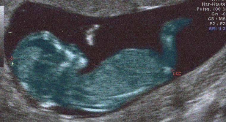 Os bebês têm guelras e caudas quando estão no útero?